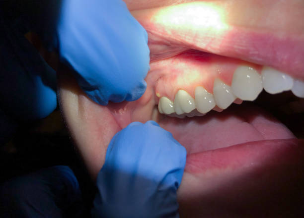 Best Cosmetic Emergency Dentistry in Lmerton, PA