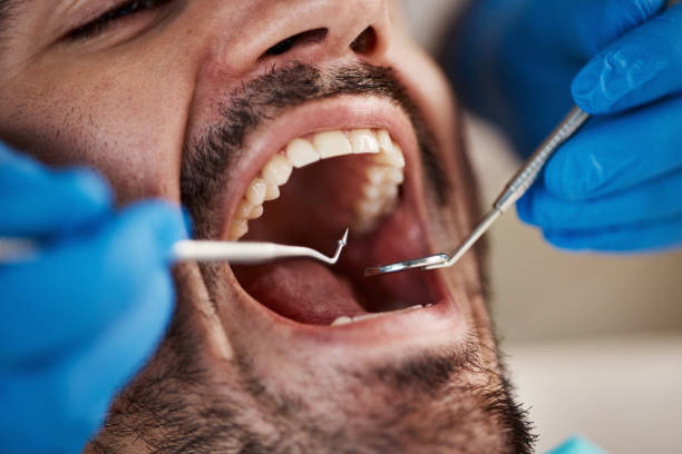 Best After-Hours Dental Trauma Care in Lmerton, PA